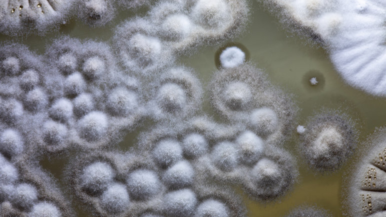 Dans le monde, 1,27 million de décès seraient liés à l’antibiorésistance.