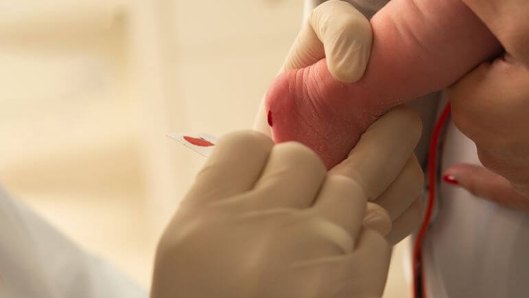<p>Quelques gouttes de sang du nouveau-né prélevées au talon sont déposées sur un papier buvard.</p>