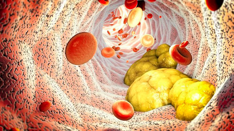 L'alirocumab augmente le nombre de récepteurs disponibles pour capter le LDL-C circulant.