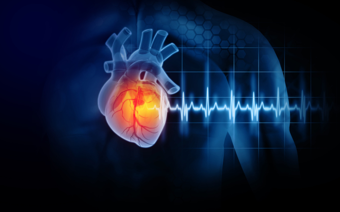 Le diagnostic de l'arythmie sous-jacente permet d'adapter la prise en charge des palpitations.