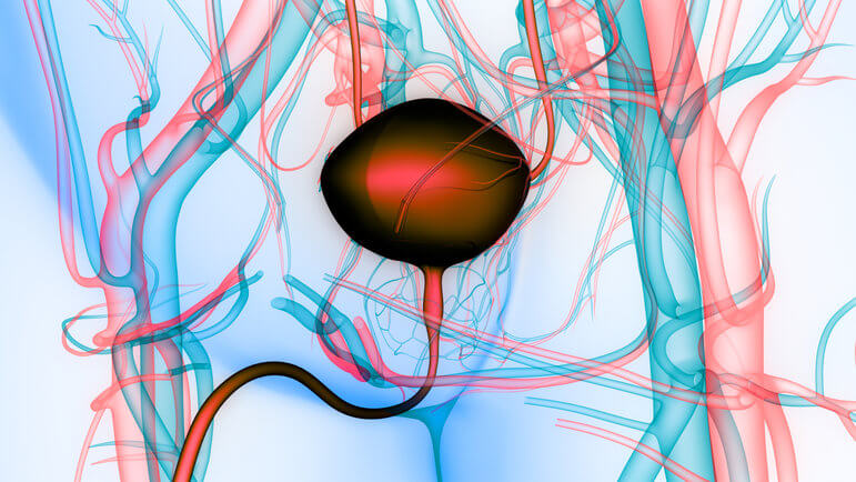 Cancer urothélial : l’erdafitinib est un inhibiteur de tyrosine kinase pan-FGFR.