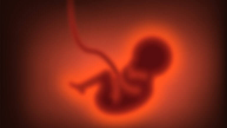 La syphilis congénitale a augmenté en France depuis 2012.
