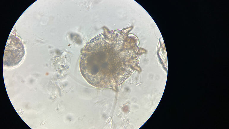 Une ectoparasitose, due à un acarien, le sarcopte.