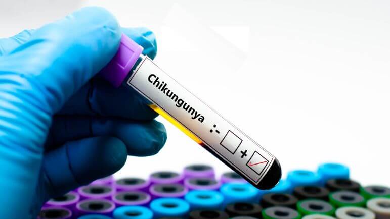 Chikungunya : le département de Mayotte est passé en phase épidémique le 27 mai 2025.