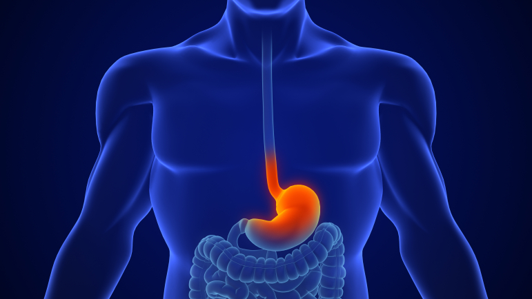 Cancer de l’œsophage : le 3e cancer digestif en France après ceux du côlon/rectum et de l’estomac.