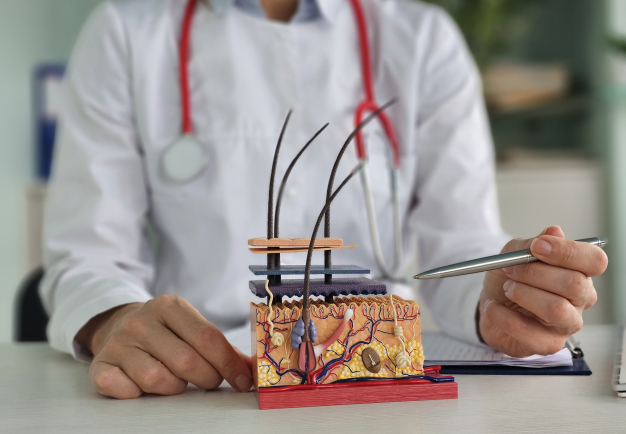 Pelade : le diagnostic est généralement clinique.