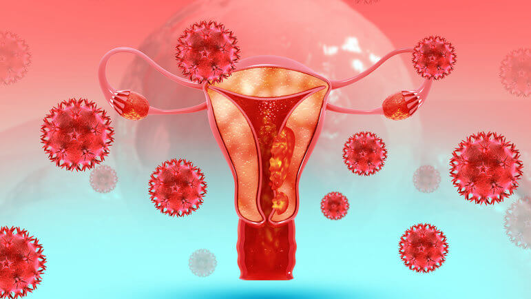 En France, le cancer du col de l'utérus est à l'origine d'environ 1 100 décès annuels.