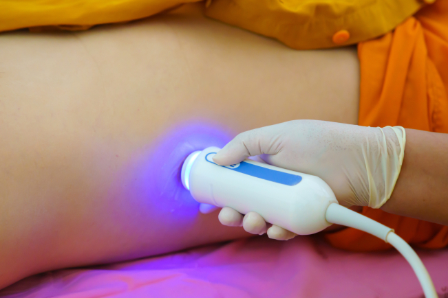 L'élastométrie (Fibroscan) précise le stade de fibrose, principal facteur pronostique de la MASH.