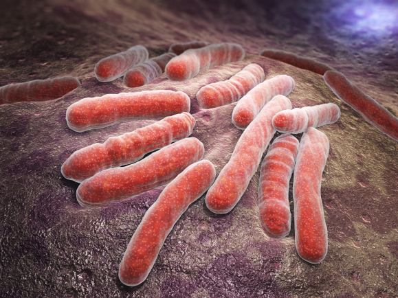 Le test de Mantoux pour rechercher une infection par Mycobacterium tuberculosis.