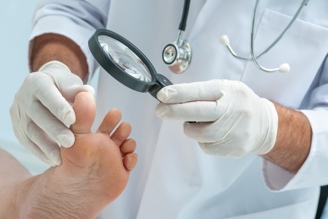 Le diagnostic clinique ne suffit pas à confirmer une onychomycose.
