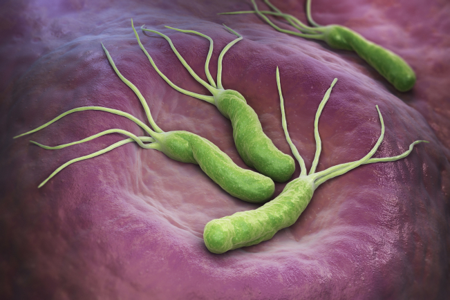 L'infection H.pylori est responsable de 760 000 nouveaux cas de cancer par an dans le monde. 