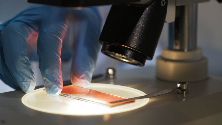 Près de 400 patients par an suivis en hématologie sont éligibles à JAYPIRCA.