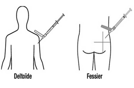 ABILIFY MAINTENA peut désormais être injecté dans le muscle deltoïde, en alternance avec le muscle fessier (illustration).