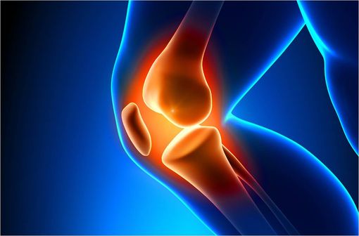 Les données disponibles ne permettant pas de confirmer l'intérêt des dispositifs médicaux à base d'acide hyaluronique en solution injectable dans la stratégie thérapeutique de l'arthrose du genou (illustration).