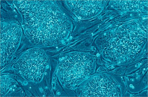 Cellules souches embryonnaires humaines encore indifférenciées (illustration @CC BY 2.5 sur Wikimedia).