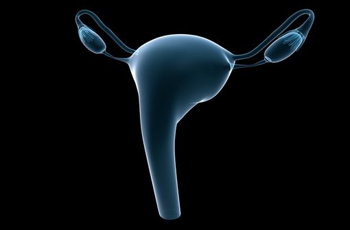 Dans les formes persistantes, en rechute ou métastatiques d’emblée du cancer du col de l'utérus, l’efficacité de la chimiothérapie demeure limitée avec une médiane de survie globale d’environ un an (illustration).
