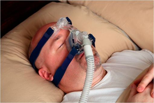 Patient souffrant d'un syndrome d'apnées du sommeil et dormant avec un dispositif de pression positive continue (illustration).