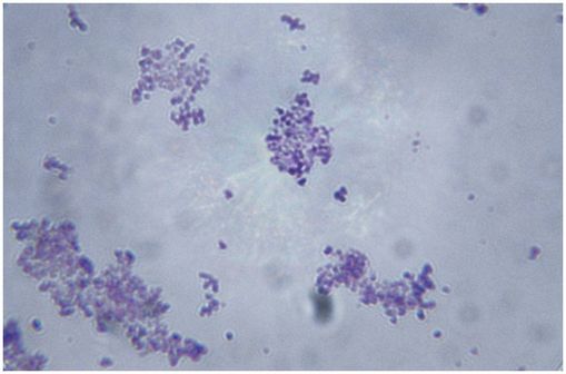 Micrographie de Staphylococcus aureus (illustration).