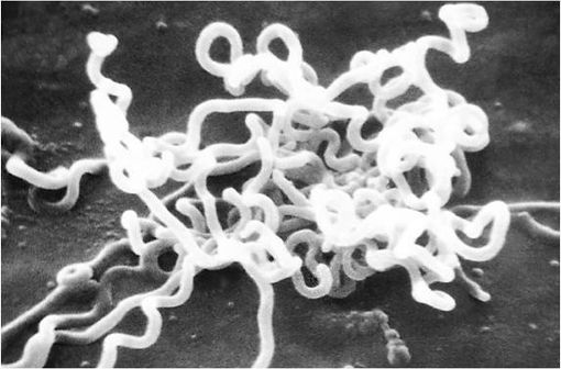 Treponema pallidum est une bactérie spirochète responsable de la syphilis. On la recherche en microscopie à fond noir dans un frottis du chancre d'inoculation (illustration @CDC/ Dr David Cox sur Wikimedia).