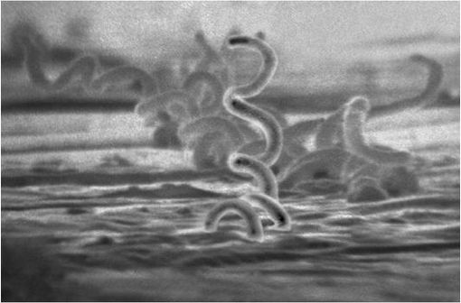 Le tréponème pâle, agent de la syphilis (illustration @Dr David Cox, CDC sur Wikimedia).