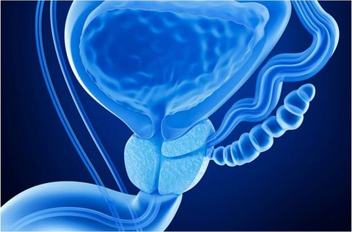 Les inhibiteurs de la LH-RH sont un traitement de référence du cancer de la prostate hormonodépendant au stade métastatique (illustration). 