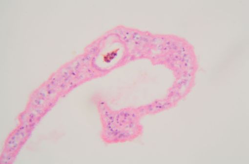 Schistosoma mansoni : vue au microscope (illustration).