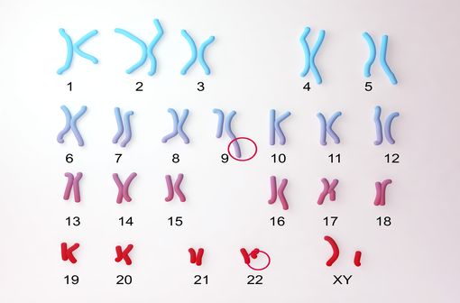 Caryotype du chromosome Philadelphie (illustration). width=