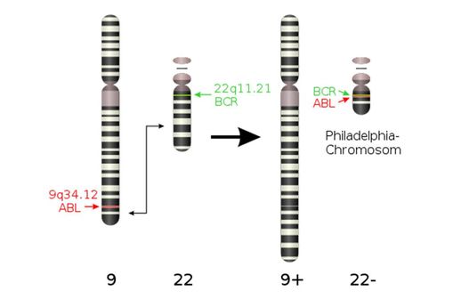 Représentation schématique de la formation du chromosome de Philadelphie (photo @ A. Obeidat sur Wikimedia).