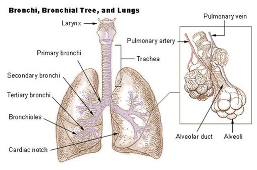 Dessin représentant des lésions de bronchectasie (illustration @ Wikimédia).
