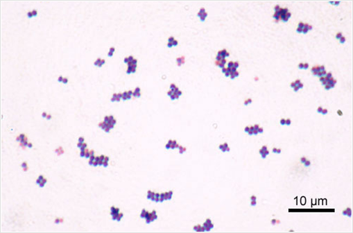 Photographie au microscope de bactéries type Staphylococcus (illustration @Y Tambe, sur Wikimedia).