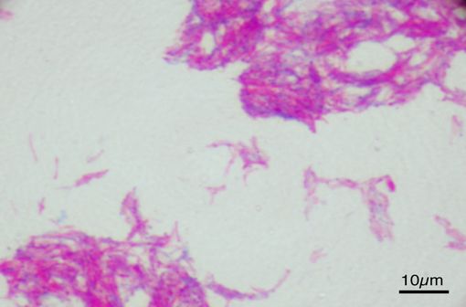 Image en microscopie du bacille Calmette-Guérin ou BCG (illustration @Y tambe sur Wikimedia).