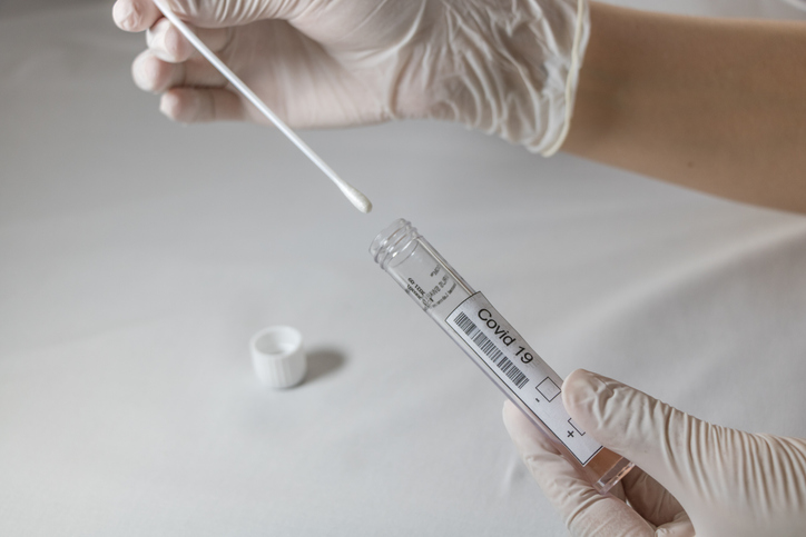 Les professionnels de santé seront amenés à pratiquer un test RT-PCR du SARS-CoV-2 au retour de leurs vacances dans 5 situations précisées par la DGS (illustration).