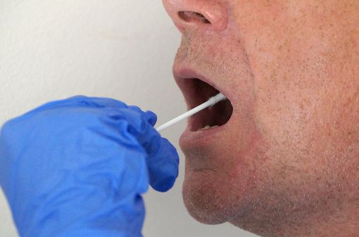 Les tests salivaires sont plus simples, moins désagréables, mais moins fiables (illustration).