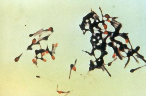 Un groupe de Clostridum tetani, bactéries responsables du tétanos (illustration, photo prise par la Centers for Disease Control and Prevention's Public Health Image Library).