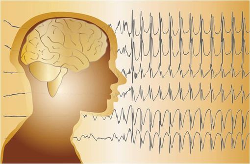 DI-HYDAN est indiqué dans le traitement de certaines formes d'épilepsie chez l'enfant et l'adulte (illustration).