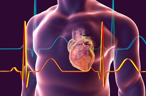 Le diclofénac expose les patients traités à des risques cardiovasculaires même à faible dose et pour des période relativement courtes (illustration).