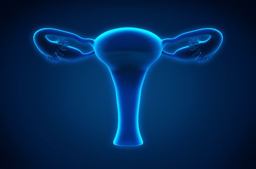 L'endométriose correspond à la présence de muqueuse utérine en dehors de la cavité de l'utérus (illustration). 