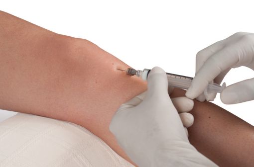 DIPROSTENE peut être utilisé en injection locale en rhumatologie, en dermatologie et en ORL (illustration).