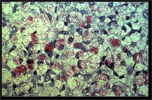 Bactérie responsable de la lèpre chez l'homme, Mycobacterium leprae (ou bacille de Hansen) est un bacille intracellulaire proche de l'agent responsable de la tuberculose (illustration @Wikimedia).