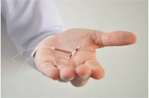 Les DIU au cuivre sont indiqués dans la contraception intra-utérine et peuvent également être utilisés en contraception d'urgence.