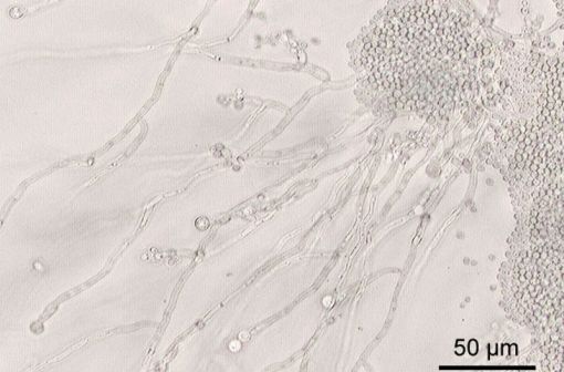 Candida albicans vus au microscope (illustration @ Y. Tambe sur Wikimedia).
