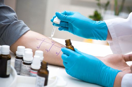 Les tests cutanés en prick sont à la base des enquêtes allergiques (illustration).