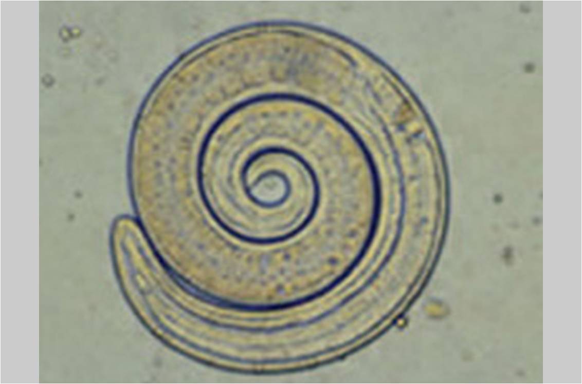 Larve de Trichinella spiralis (illustration @CDC sur Wikimedia).