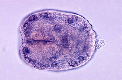 Protoscolex d'Echinococcus granulosus issu d'un kyste hydatique (illustration @CDC/Dr. L.L.A. Moore sur Wikimedia).