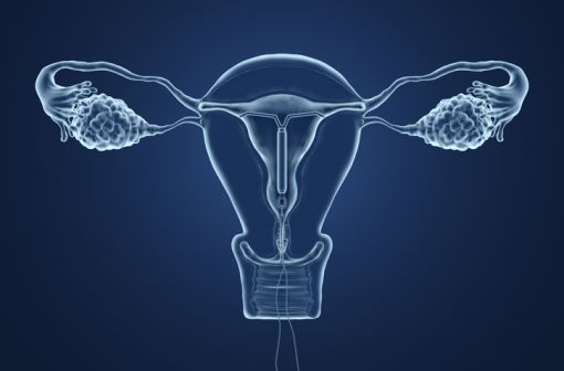 Représentation en 3D d'un dispositif intra-utérin en place au sein d'un utérus (illustration).