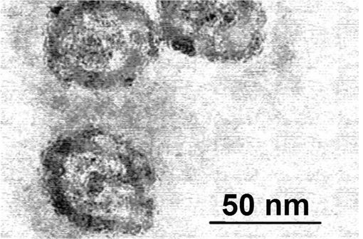 Virus de l'hépatite C en microscopie électronique à balayage (illustration @PhD Dre, sur Wikimedia).
