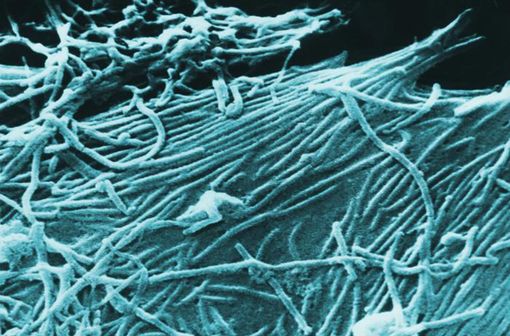 Virions d'Ebola vus au microscope électronique à balayage (© 2005 Public Library of Science via Wikimedia Commons) 