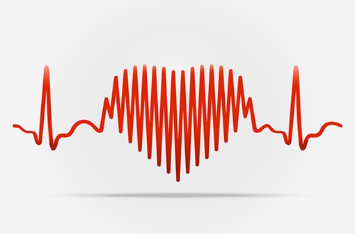 La fibrillation auriculaire est associée à une augmentation de la mortalité, du risque d'accidents cardiovasculaires et d'insuffisance rénale chronique (image d'illustration ne représentant pas une FA).