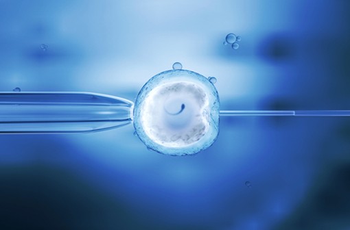 Cancer et fertilité : première naissance française après vitrification ovocytaire