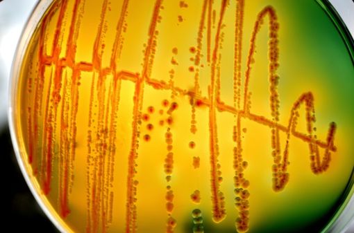 Les entérobactéries de la famille des Escherichia coli sont les causes les plus fréquentes des cystites aiguës de la femme (illustration). 